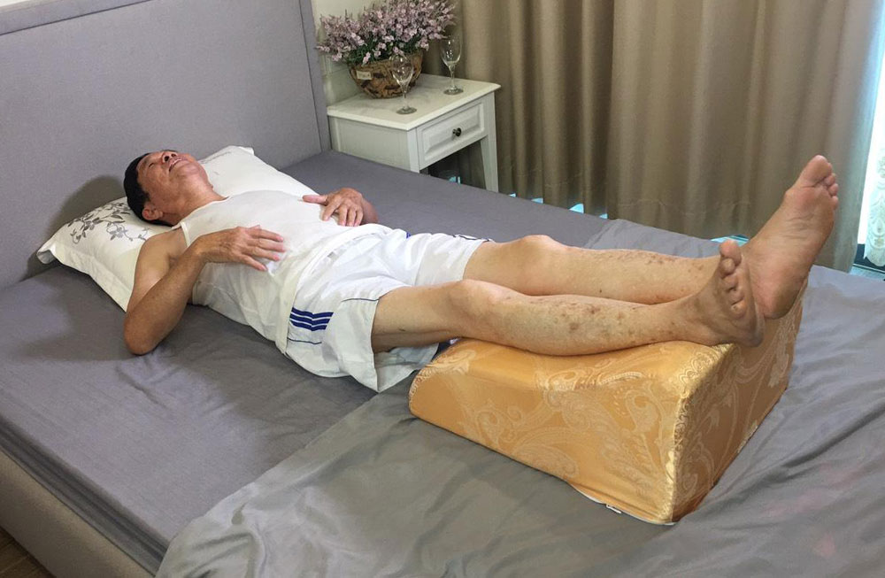Gối giãn tĩnh mạch